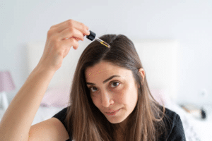 Hair Loss